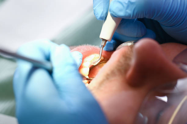 Best Chipped Tooth Repair Near Me  in Ponca City, OK