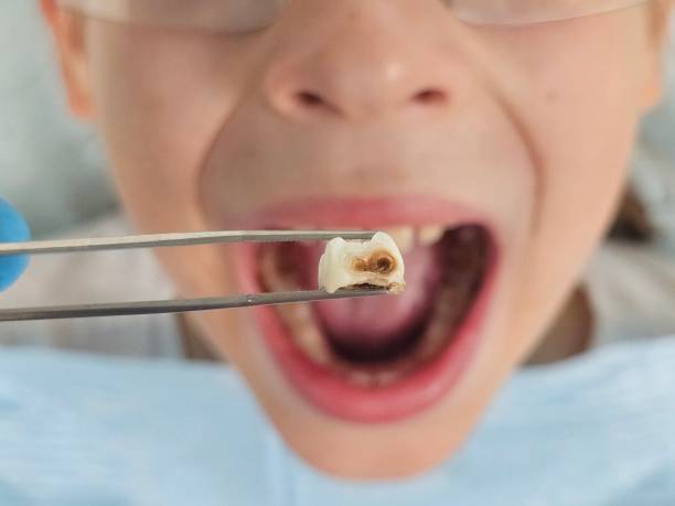 Best Tooth Infection Emergency Dentist  in Ponca City, OK